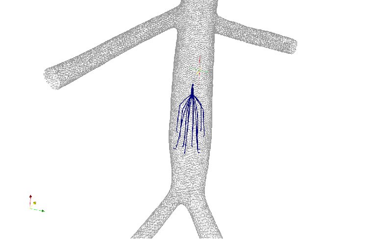 Idealized IVC Model